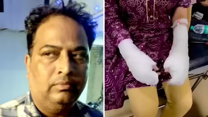 દિલ્હી એસિડ એટેકમાં નવો વણાંક, પીડિત છોકરીના પિતાએ જ....