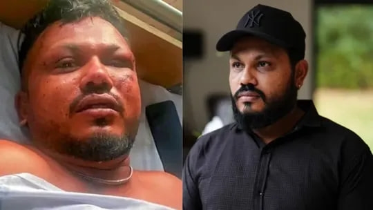 અમદાવાદ પ્લેન ક્રેશનો એકમાત્ર જીવતો બચેલો પીડિત અત્યારે કઈ હાલતમાં છે? જે જાણકારી મળી છે તે ખૂબ