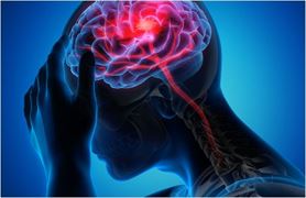 શું તમે પણ 'સ્ટ્રોક'ના આ લક્ષણોને નજરઅંદાજ તો નથી કરી રહ્યા ને? ઘરે બેઠા આજે જ તપાસો આ રીતે?