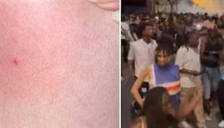 Syringe Attack at France Music Festival: ફ્રાન્સમાં નવો આતંક: ભીડમાં મહિલાઓને લગાવવામાં આવી રહી