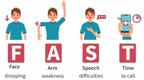 FAST ટેસ્ટથી સ્ટ્રોકની ઓળખ કરો