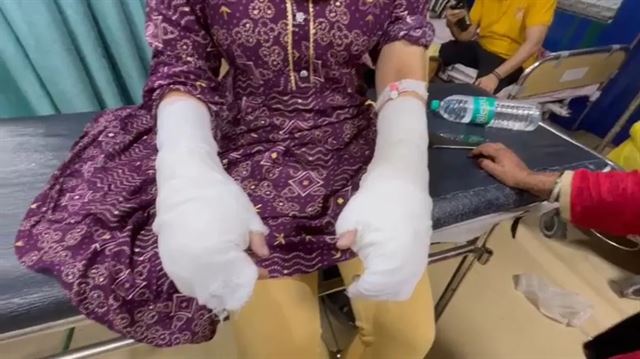 એટેકમાં પીડિતાનો હાથ દાઝી ગયો