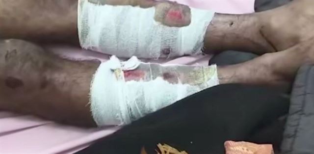 શું છે આખો મામલો?